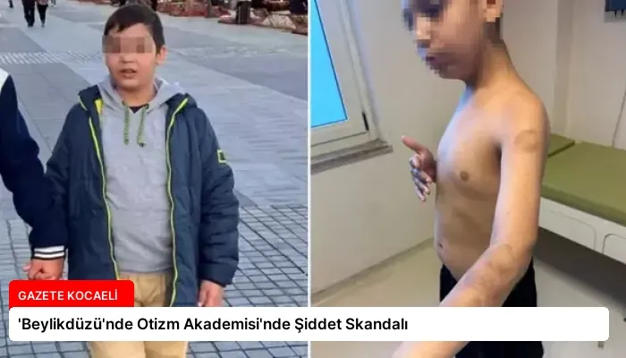 ‘Beylikdüzü’nde Otizm Akademisi’nde Şiddet Skandalı