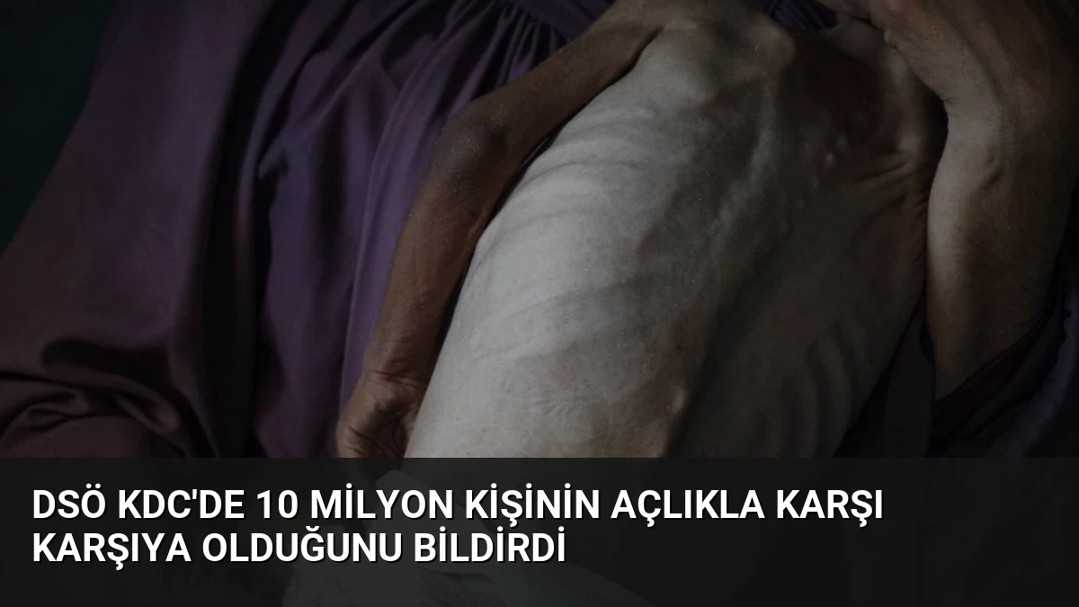 DSÖ KDC’de 10 Milyon Kişinin Açlıkla Karşı Karşıya Olduğunu Bildirdi