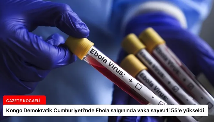 Kongo Demokratik Cumhuriyeti’nde Ebola salgınında vaka sayısı 1155’e yükseldi